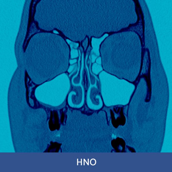 RFN online. Wochenendkurs HNO-Diagnostik, 15.-16. Februar 2025