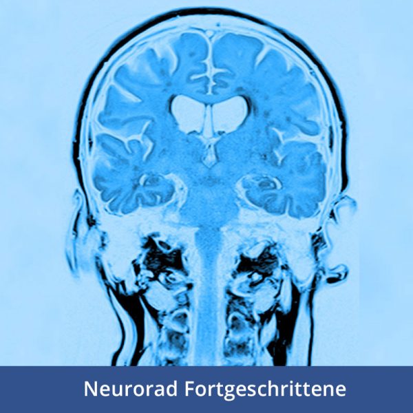 RFN online - Wochenendkurs Neuroradiologie 2, 29.-30. März 2025